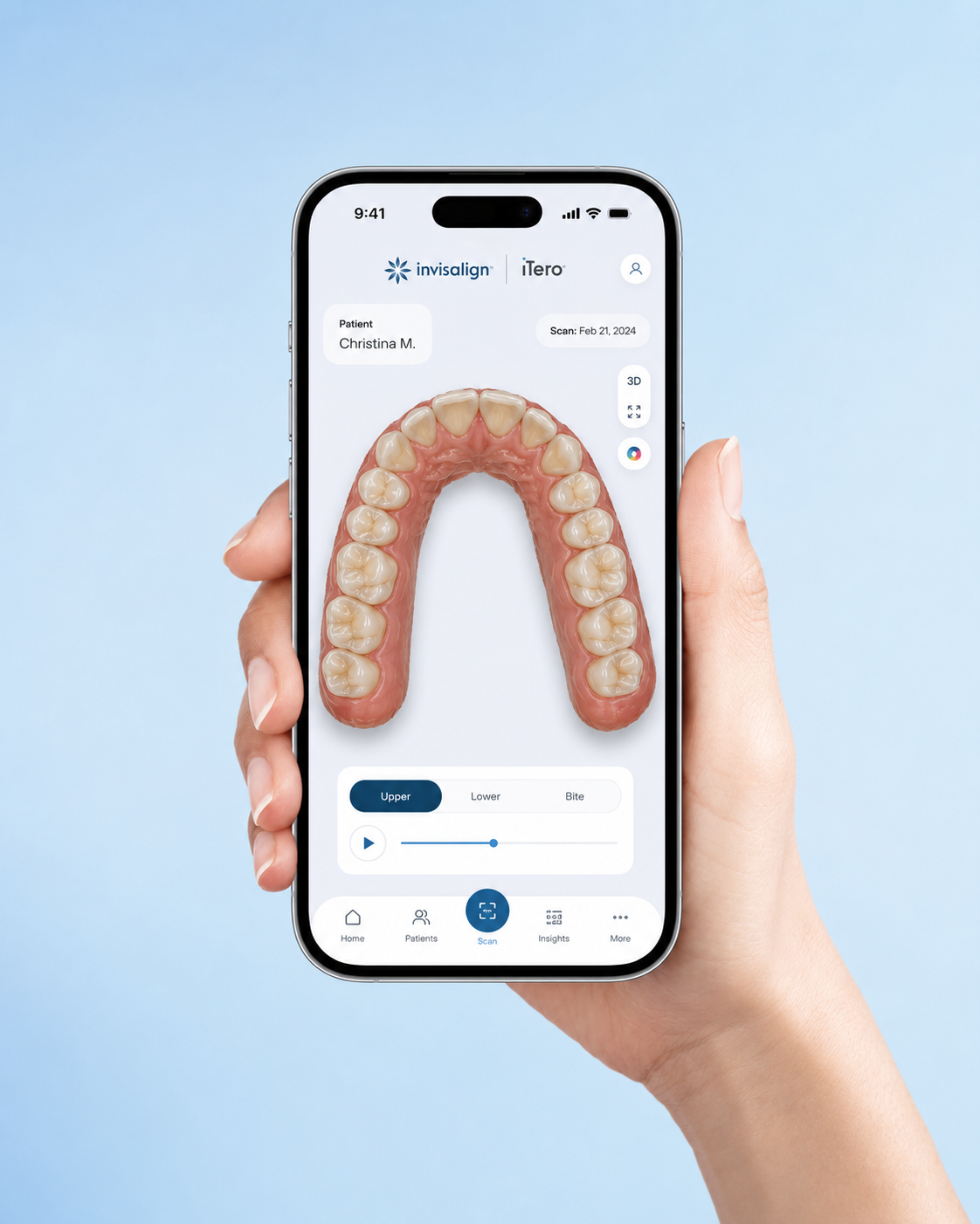 Invisalign iTero smile scan preview shown on a phone at Cadbury Dental, Birmingham